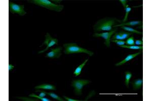 Immunofluorescence of purified MaxPab antibody to OAS1 on HeLa cell. (OAS1 anticorps  (AA 1-364))