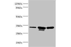 Western blot All lanes: CAPZB antibody at 6 μg/mL Lane 1: 293T whole cell lysate Lane 2: A431 whole cell lysate Lane 3: Jurkat whole cell lysate Secondary Goat polyclonal to rabbit IgG at 1/10000 dilution Predicted band size: 32, 31 kDa Observed band size: 32, 31 kDa (CAPZB anticorps  (AA 1-272))