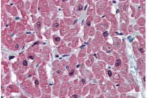 Human Heart: Formalin-Fixed, Paraffin-Embedded (FFPE) (TNNC1 anticorps  (AA 1-162))