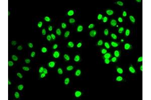 Immunofluorescence analysis of MCF7 cell using REST antibody. (REST anticorps)