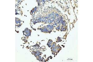 IHC analysis of GRPEL1 using anti-GRPEL1 antibody (ABIN7602643). (GRPEL1 anticorps  (AA 90-217))