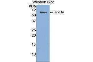 Detection of Recombinant CTSA, Human using Polyclonal Antibody to Cathepsin A (CTSA) (CTSA anticorps  (AA 215-470))