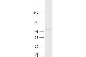 Validation with Western Blot