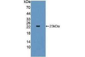 Figure. (Adenylate Kinase 2 anticorps  (AA 64-232))