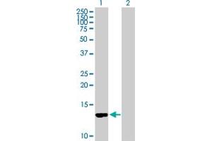 Western Blot analysis of CD59 expression in transfected 293T cell line by CD59 MaxPab polyclonal antibody. (CD59 anticorps  (AA 1-128))