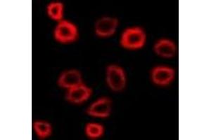Immunofluorescent analysis of N-WASP staining in SW480 cells. (Neural Wiskott-Aldrich syndrome protein (WASL) anticorps)