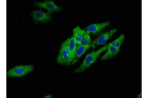 Immunofluorescent analysis of Hela cells using ABIN7142618 at dilution of 1:100 and Alexa Fluor 488-congugated AffiniPure Goat Anti-Rabbit IgG(H+L)