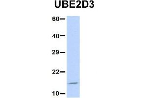 Host:  Rabbit  Target Name:  UBE2D3  Sample Type:  Jurkat  Antibody Dilution:  1. (UBE2D3 anticorps  (N-Term))