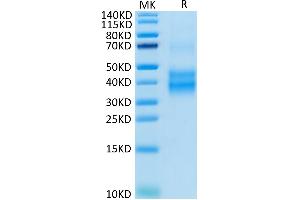 Human NKG2A/CD159a on Tris-Bis PAGE under reduced condition.