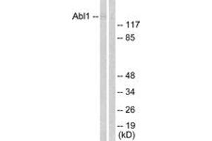 Western blot analysis of extracts from COS7 cells, treated with Adriamycin 0. (ABL1 anticorps  (AA 156-205))