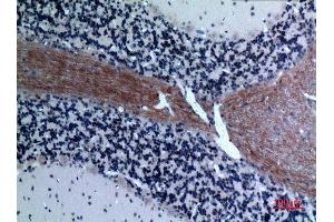 Immunohistochemistry (IHC) analysis of paraffin-embedded Rat Brain, antibody was diluted at 1:100. (CCL26 anticorps  (Internal Region))