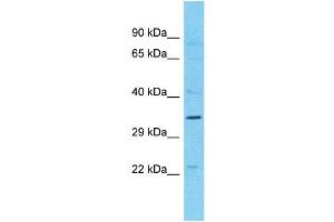 Western Blotting (WB) image for anti-Melanoma Antigen Family B, 10 (MAGEB10) (N-Term) antibody (ABIN2791656) (MAGEB10 anticorps  (N-Term))