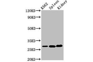 Western Blot Positive WB detected in: K562 whole cell lysate, Mouse spleen tissue, Mouse kidney tissue All lanes: CA1 antibody at 6. (CA1 anticorps  (AA 2-261))