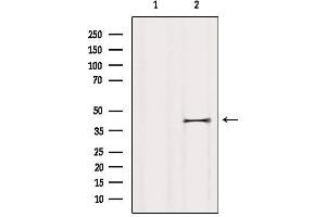Western blot analysis of extracts from HUVEC, using P2RY5 Antibody.