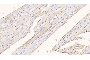 Detection of ALB in Rat Cardiac Muscle Tissue using Polyclonal Antibody to Albumin (ALB) (Albumin anticorps)