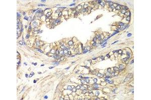 Immunohistochemistry of paraffin-embedded Human prostate using SLC4A4 / NBC Polyclonal Antibody at dilution of 1:100 (40x lens). (SLC4A4 anticorps)