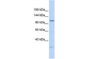 WB Suggested Anti-SKIV2L2 Antibody Titration:  0. (MTR4 anticorps  (N-Term))