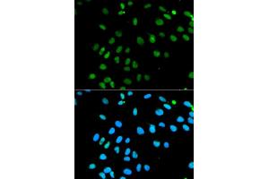 Immunofluorescence analysis of MCF7 cell using MNAT1 antibody. (MNAT1 anticorps)