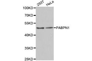 Western Blotting (WB) image for anti-Poly A Binding Protein Nuclear 1 (PABPN1) antibody (ABIN1877070) (PABPN1 anticorps)