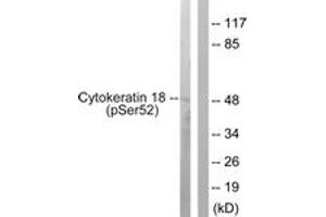Western blot analysis of extracts from HepG2 cells, using Keratin 18 (Phospho-Ser52) Antibody. (Cytokeratin 18 anticorps  (pSer52))
