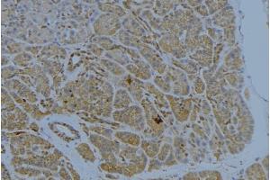 ABIN6272341 at 1/100 staining Human pancreas tissue by IHC-P. (ST14 anticorps  (Internal Region))