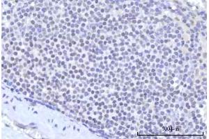 IHC analysis of RBM22 using anti-RBM22 antibody (ABIN7600268). (RBM22 anticorps  (AA 17-406))