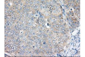 Immunohistochemical staining of paraffin-embedded Human liver tissue using anti-H6PD mouse monoclonal antibody. (Glucose-6-Phosphate Dehydrogenase anticorps)