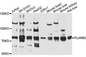 Western blot analysis of extracts of various cells, using PLXNB2 antibody. (Plexin B2 anticorps)
