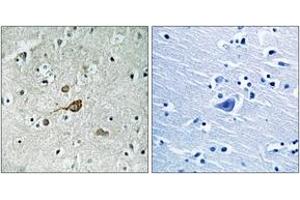 Immunohistochemistry analysis of paraffin-embedded human brain tissue, using c-Abl (Ab-412) Antibody. (ABL1 anticorps  (AA 406-455))