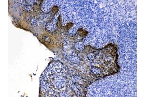 Cytokeratin 5 was detected in paraffin-embedded sections of human tonsil tissues using rabbit anti- Cytokeratin 5 Antigen Affinity purified polyclonal antibody (Catalog # ) at 1 µg/mL. (Cytokeratin 5 anticorps  (Middle Region))