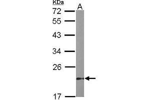 WB Image Sample (50 ug of whole cell lysate) A: mouse stomach 12% SDS PAGE antibody diluted at 1:1000
