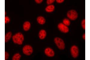 ABIN6267070 staining lovo cells by ICC/IF.