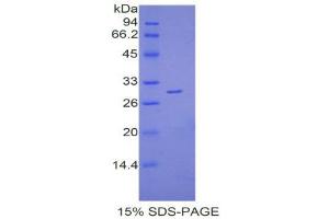 SDS-PAGE (SDS) image for Lymphocyte Antigen 9 (CD229) (AA 384-642) protein (His tag) (ABIN1878507)