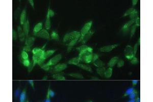 Immunofluorescence analysis of NIH-3T3 cells using LRPAP1 Polyclonal Antibody at dilution of 1:100 (40x lens). (LRPAP1 anticorps)