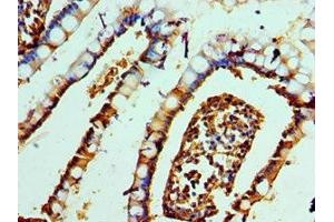 Immunohistochemistry of paraffin-embedded human small intestine tissue using ABIN7161506 at dilution of 1:100