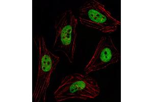 Fluorescent image of Hela cell stained with PITX2 Antibody . (PITX2 anticorps  (AA 122-151))