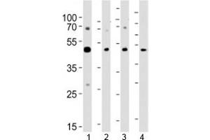 Western blot analysis of lysate from 1) A431, 2) K562, 3) CEM cell line and 4) rat brain tissue using SUV39H2 antibody at 1:1000.