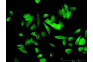 Immunofluorescence of purified MaxPab antibody to ME1 on HeLa cell. (ME1 anticorps  (AA 1-572))