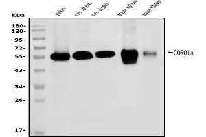 Western blot analysis of Coronin 1a/TACO/CORO1A using anti-Coronin 1a/TACO/CORO1A antibody (ABIN7600292).