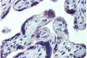 Anti-CXCR6 antibody IHC staining of human placenta. (CXCR6 anticorps  (AA 82-142))