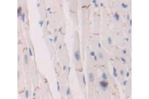 IHC-P analysis of Mouse Tissue, with DAB staining. (Insulin Receptor anticorps  (AA 1101-1372))