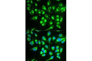 Immunofluorescence analysis of MCF7 cell using SLC22A5 antibody. (SLC22A5 anticorps  (AA 1-180))