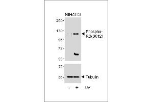 Western blot analysis of lysates from NIH/3T3 cell line, untreated or treated with UV(2h), using Phospho-RB Antibody (upper) or Tubulin (lower). (Retinoblastoma 1 anticorps  (pSer612))