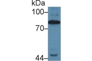 Detection of C4 in Human Serum using Polyclonal Antibody to Complement Component 4 (C4)