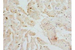 Immunohistochemistry of paraffin-embedded human heart tissue using ABIN7149014 at dilution of 1:100