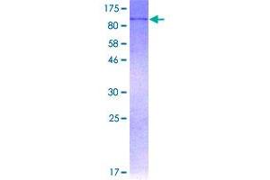 Image no. 1 for Amine Oxidase, Copper Containing 3 (Vascular Adhesion Protein 1) (AOC3) (AA 1-763) protein (GST tag) (ABIN1345218)