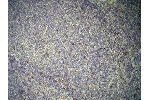 Immunohistochemistry (IHC) image for anti-CD7 (CD7) (AA 221-238), (C-Term) antibody (ABIN870611)