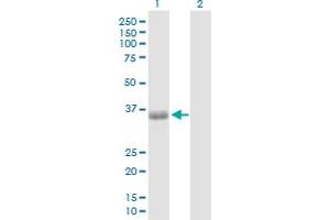 Western Blot analysis of PHF11 expression in transfected 293T cell line by PHF11 MaxPab polyclonal antibody. (PHF11 anticorps  (AA 1-292))