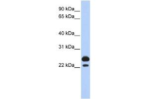 WB Suggested Anti-AK1 Antibody Titration:  0. (Adenylate Kinase 1 anticorps  (Middle Region))