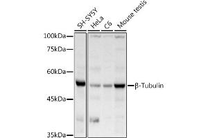 Western blot analysis of extracts of various cell lines, using β-Tubulin antibody (ABIN3020552, ABIN3020553 and ABIN3020554) at 1:1000 dilution. (TUBB anticorps  (AA 40-260))
